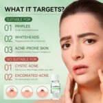 LANBENA Precision Acne Spot Serum, Acne Drying Lotion, Overnight Acne Treatment For Face, Dry Out Pimples, Blemishes, Zits And Clean Pores, 0.42 Fl Oz - Image 4