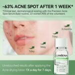 LANBENA Precision Acne Spot Serum, Acne Drying Lotion, Overnight Acne Treatment For Face, Dry Out Pimples, Blemishes, Zits And Clean Pores, 0.42 Fl Oz - Image 5