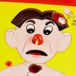 Operation Electronic Board Game, Family Games for Kids Ages 6+, Kids Board Games for 1+ Players, Funny Games for Kids, Kids Gifts (Amazon Exclusive) - Image 7