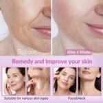 Neck Firming Creams for Tightening and Firming, Moisturizer Face Cream with Collagen, Hyaluronic Acid, Day & Night Anti-Aging Skin Tightening Cream for Neck, Décolleté & Face – 1.7Fl Oz - Image 3