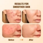 Salicylic Acid 2% Serum Solution for Face: Gently Exfoliating Facial Serum for Acne,Blackhead & Open Pores & Reduces Excess Oil - Hydrating& Soothing Skin Care Serum for Acne Prone&Oily Skin - Image 3