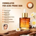 Salicylic Acid 2% Serum Solution for Face: Gently Exfoliating Facial Serum for Acne,Blackhead & Open Pores & Reduces Excess Oil - Hydrating& Soothing Skin Care Serum for Acne Prone&Oily Skin - Image 7