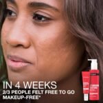 Neutrogena Stubborn Blackheads Daily Acne Facial Serum with Salicylic, Glycolic, Polyhydroxy & Mandelic Acids, Oil-Free Face Serum for Acne-Prone Skin to Help Clear Clogged Pores, 1 fl. oz - Image 6