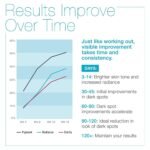 MD Complete Dark Spot Corrector | Anti-Aging | Professional Dark Spot Correction | With Tranexamic Acid, Vitamins C + E, Alpha Arbutin and Licorice Extracts 1.0 fl oz - Image 5