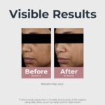 Eucerin Radiant Tone Dual Serum Dark Spot Corrector, Dark Spot Serum with Thiamidol and Hyaluronic Acid, Helps Visibly Reduce the Look of Persistent Dark Spots, 1 Fl Oz Bottle - Image 7