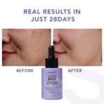 Dark Spot Correcting Glow Serum: Melasma Hyperpigmentation Treatment for Face with Tranexamic Acid Niacinamide - Vitamin C Serum and Dark Spot Remover For Face - Image 5