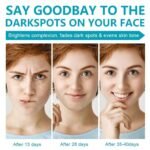 Dark Spot Remover for Face, Fast-Acting Dark Spot Corrector Remover for Face and body Hyperpigmentation, Fades Melasma, Freckle, Sun Spots, Evens Skin Tone, Age Spot Remover for Women Men - Image 4
