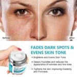 Dark Spot Remover for Face, Fast-Acting Dark Spot Corrector Remover for Face and body Hyperpigmentation, Fades Melasma, Freckle, Sun Spots, Evens Skin Tone, Age Spot Remover for Women Men - Image 5
