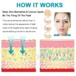 Dark Spot Remover for Face, Fast-Acting Dark Spot Corrector Remover for Face and body Hyperpigmentation, Fades Melasma, Freckle, Sun Spots, Evens Skin Tone, Age Spot Remover for Women Men - Image 6