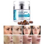 Dark Spot Remover for Face, Fast-Acting Dark Spot Corrector Remover for Face and body Hyperpigmentation, Fades Melasma, Freckle, Sun Spots, Evens Skin Tone, Age Spot Remover for Women Men - Image 2