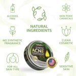 Cystic Acne Spot Treatment – Tea Tree Acne Cream – Fast-Acting Acne Spot Corrector for Face, Pimples & Blemishes – Non-Greasy, Gentle Formula – 1oz – by WELLUTION - Image 9