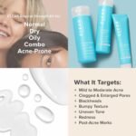 Paula's Choice CLEAR 3-Piece Acne Kit, Includes Daily Cleanser, 2% Salicylic Acid Exfoliant & Benzoyl Peroxide Treatment, Prevents & Treats Mild to Severe Acne & Breakouts, Fragrance-Free, Set of 3 - Image 5