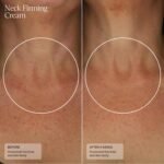 Senté Firming Neck Cream for Crepey Skin & Vertical Lines | Lifts, Firms & Smooths Neck & Décolleté | HSA, Caffeine, Vitamin C | 1.7 Fl Oz - Image 6