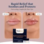 1% Hydrocortisone Lip Balm – Petrolatum-Free Relief for Chapped, Dry, or Irritated Lips due to Accutane, Isotretinoin associated Cheilitis, Weather Damage, and more - Unflavored - Image 4